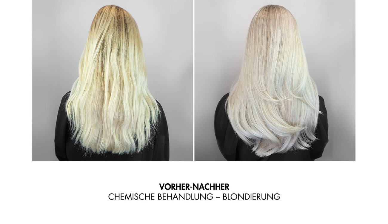TRIJUVEN Behandlung Ergebnisbild 1.