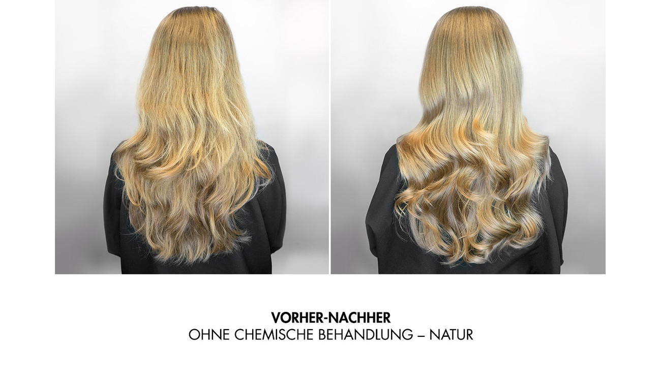 TRIJUVEN Behandlung Ergebnisbild 2.